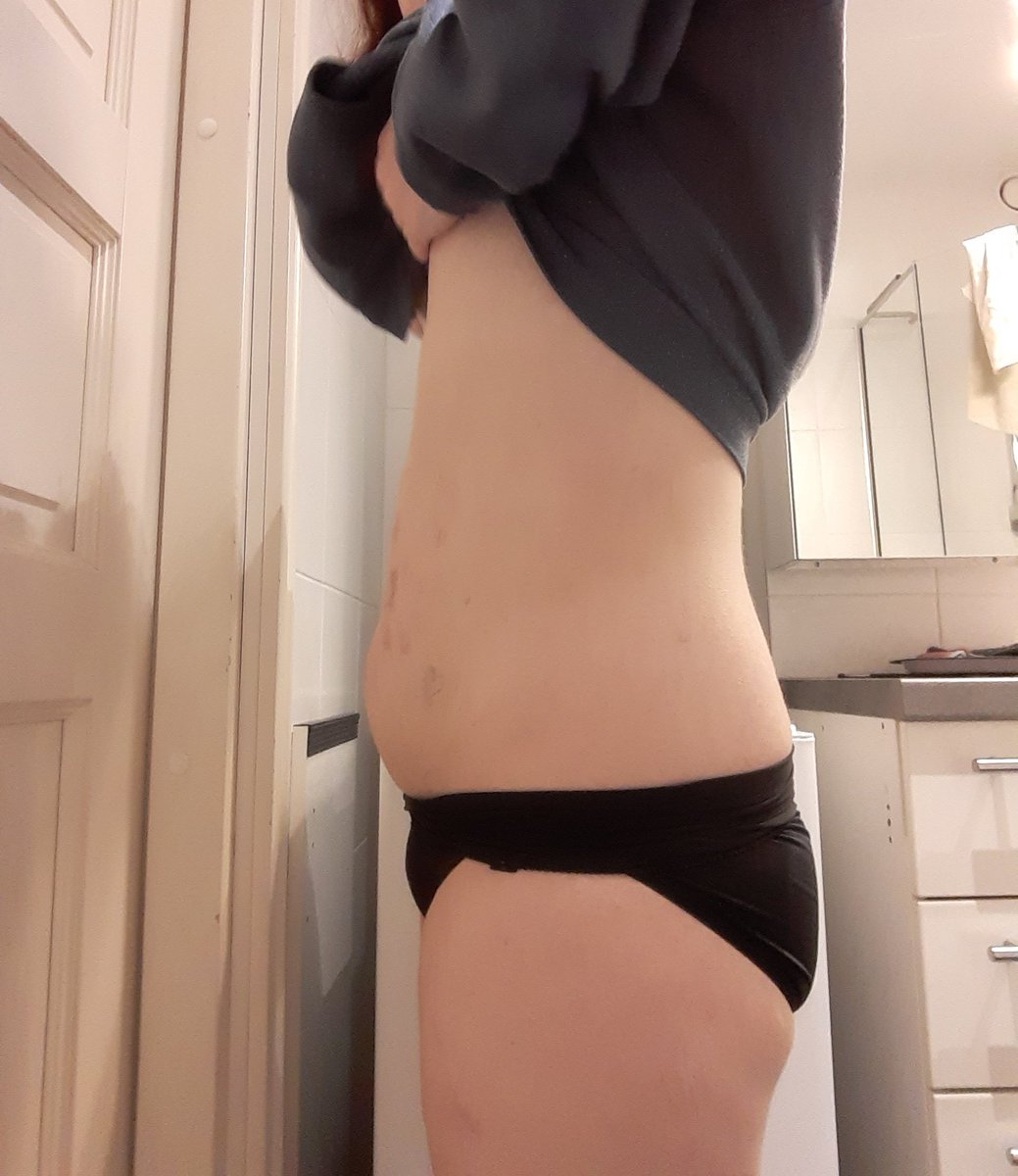 frankisdying420's tweet image. in six months,a lot can change. Only if you want to tho. Bmi 30-Bmi 25. Its been rough but im still loosing and fighting so i one day will be skinny