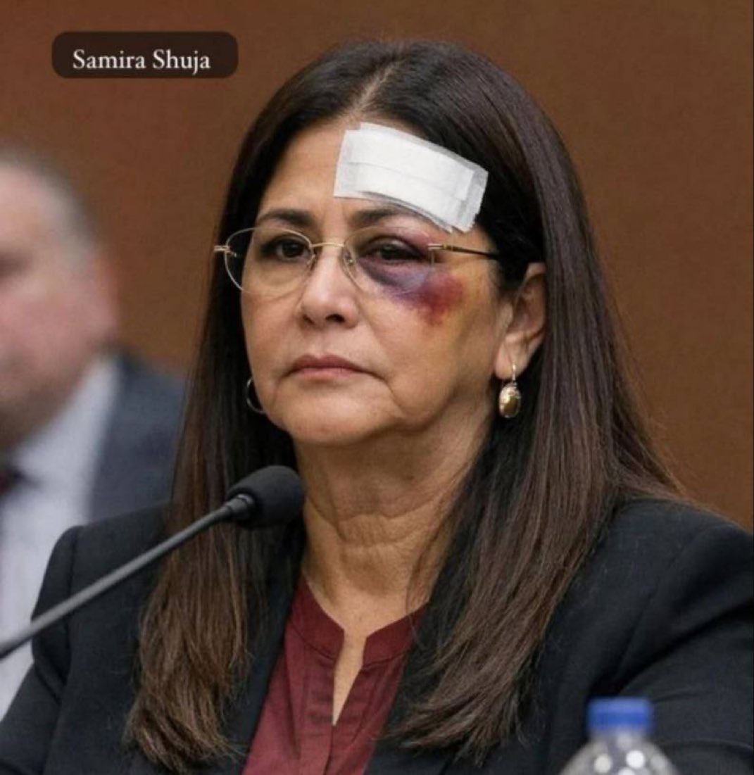 ⛔️ظهرت زوجة مادورو في محكمة نيويورك مع علامات واضحة على الضرب والكدمات على وجهها.‼️

⛔️ترامب، الذي يتحدث بشكل هستيري عن انتهاكات حقوق الإنسان في إيران، هو نفسه دليل حي على معاملته اللاإنسانية والخسيسة للمرأة.‼️