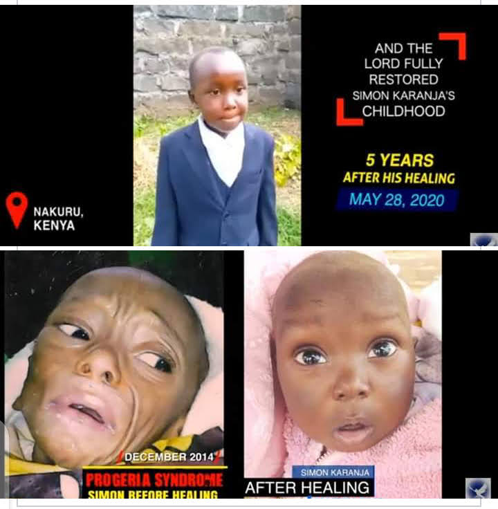 PROGERIA SYNDROME healed at The Decree of The Eternal Blood of JESUS by The PROPHET of GOD, Prophet Dr. Owuor.

This is a confirmation that indeed The Messiah is COMING.

Repent &amp; Prepare The Way
#RighteousnessCall