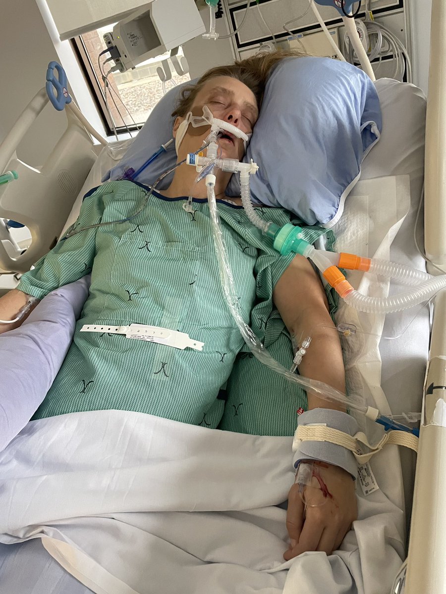 katynotie's tweet image. Hi friends!
I died for a bit. For reals. But I came back.
Full cardiac arrest. Healing up well!