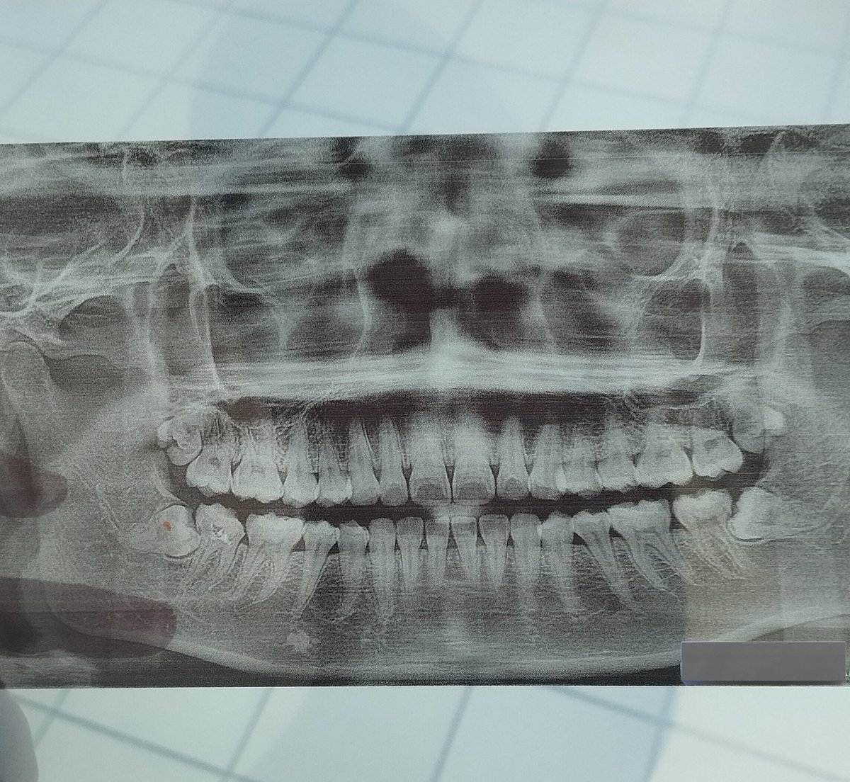 kodzuma rest tweet media