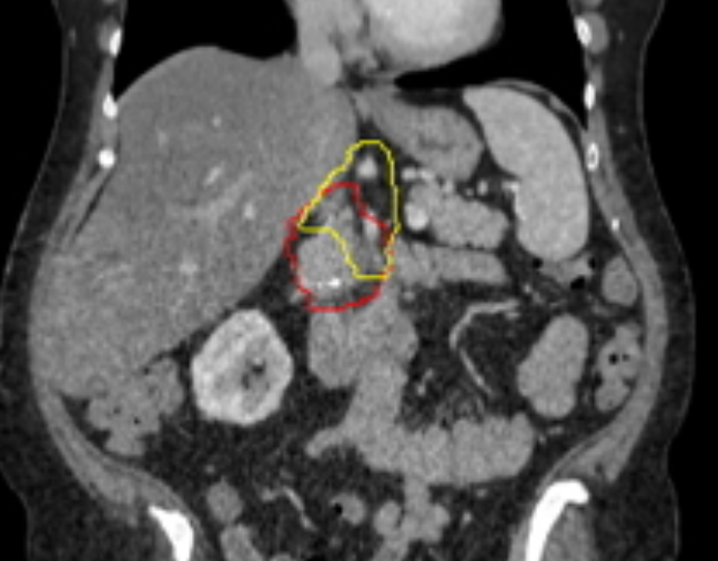 Hopkins inHealth tweet media