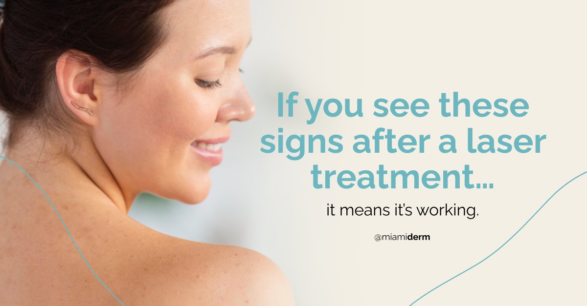 DrMiamiDerm's tweet image. The tiny dots you see after a #lasertreatment?

That’s your #collagen waking up. The Multifrax Laser creates controlled micro-injuries that trigger healing + collagen remodeling.

Great for texture, scars &amp;amp; fine lines.
Book with me at #MiamiDerm
drannachacon.com