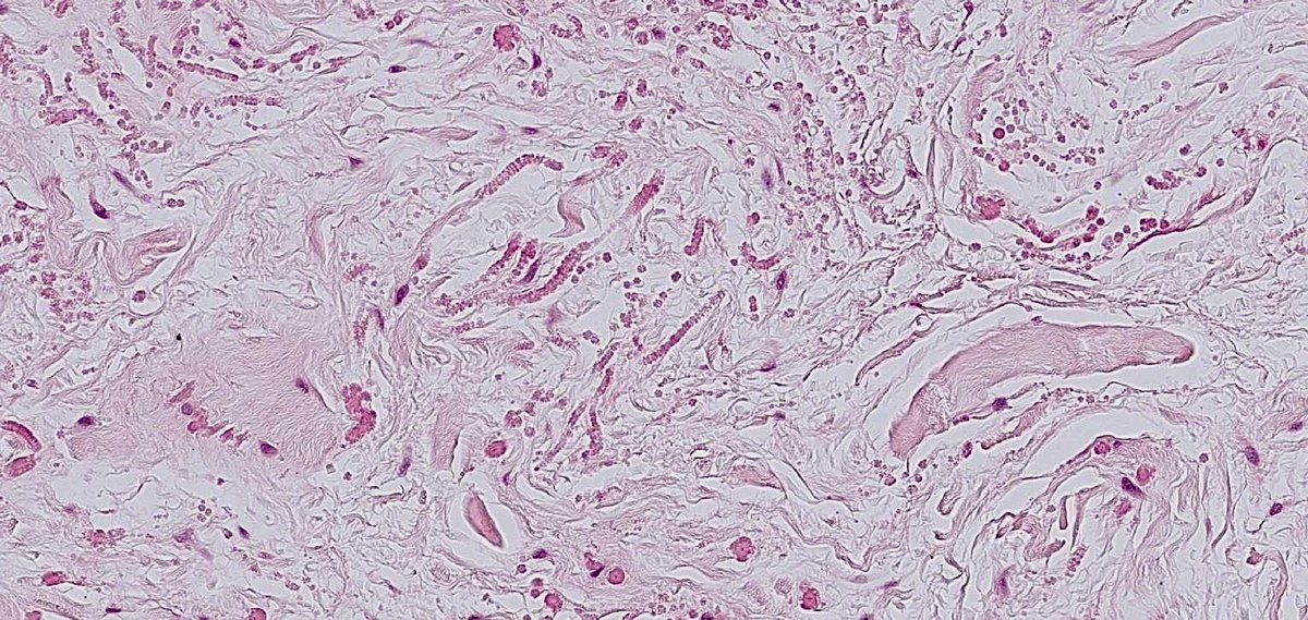 Runjan Chetty tweet media