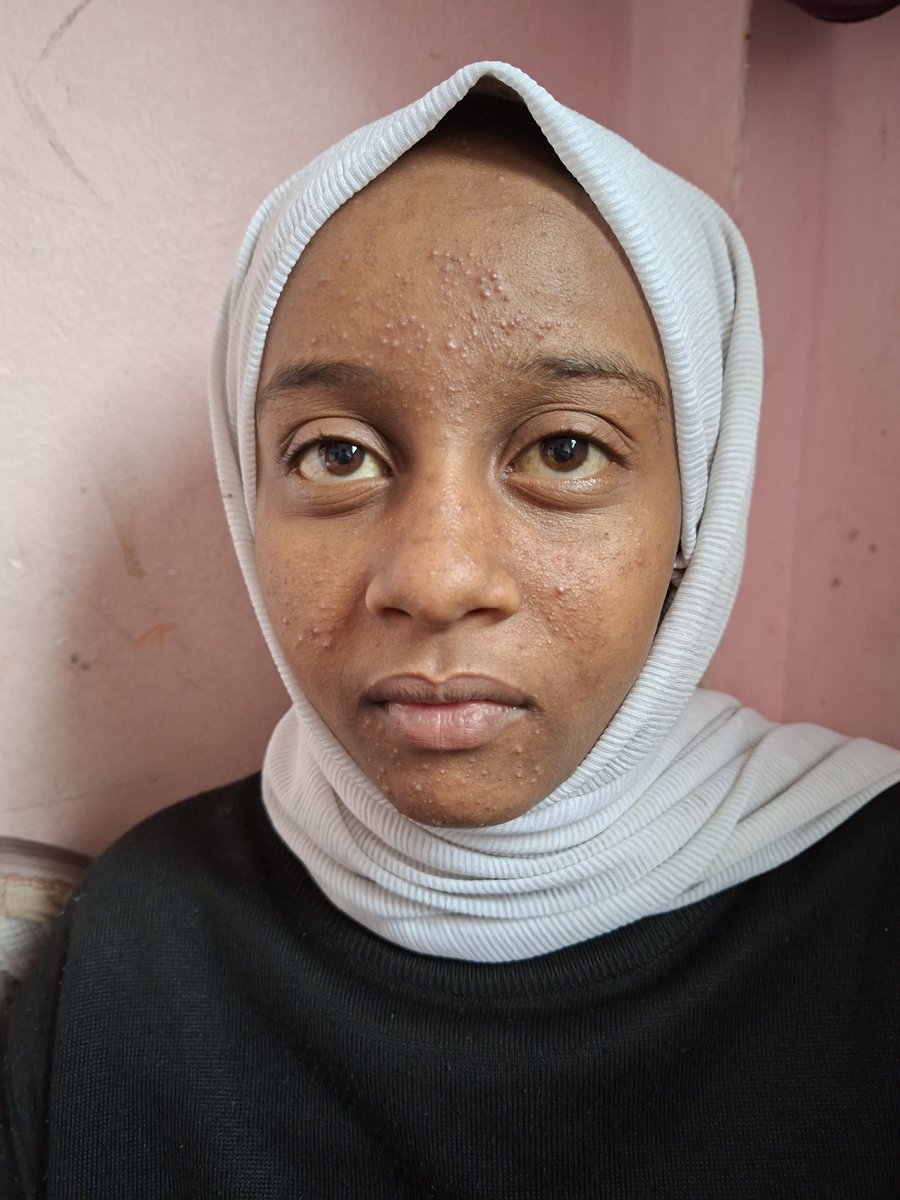 IGaza72496's tweet image. five days have passedwithout any donations,and my sister still hasn't received her medication.Her health has deteriorated significantly;she's become unable to move,her face is covered in pimples,her eyes are yellow,and her body is swollen
 Please help me! 
chuffed.org/project/134790