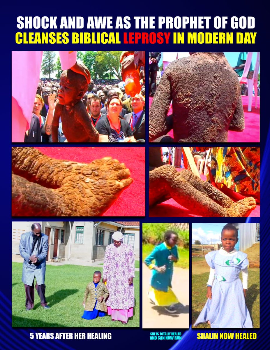 These supernatural healings are not meant for disputation, they are trumpeting
#RighteousnessCall to this apostate generation.