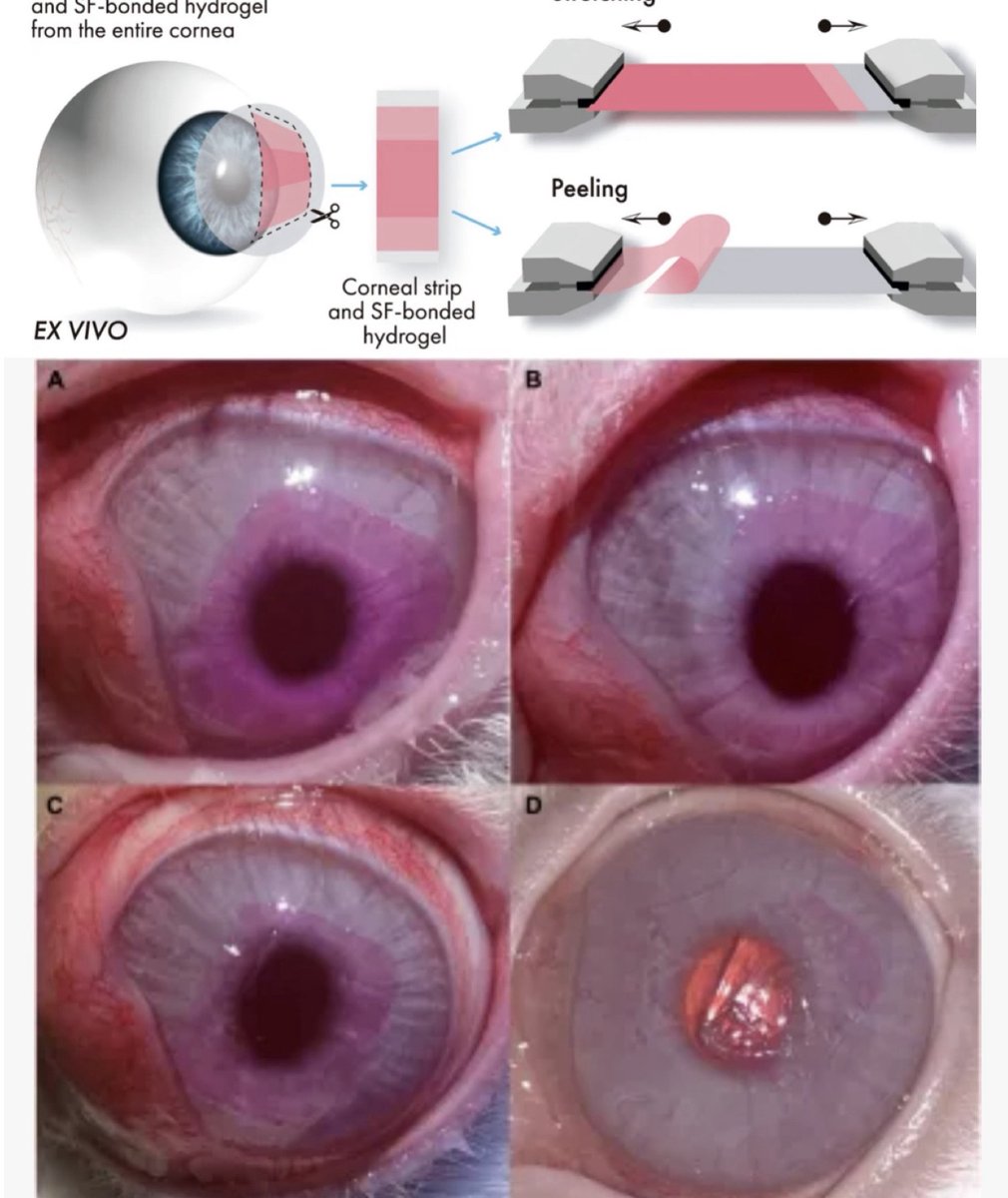 MarcoslabUr's tweet photo. Our 1st paper of the year: #Photobonding of #silk hydrogels to #cornea, for corneal bandage applications, in @FrontBioeng ; @ERC_Research #SilkEye; @MarcoslabUr @VioBioLab @IO_CSIC @csic @cvsuor @UVa_es @MGHMedicine @harvard @UofR https://t.co/vleGa3rJzV