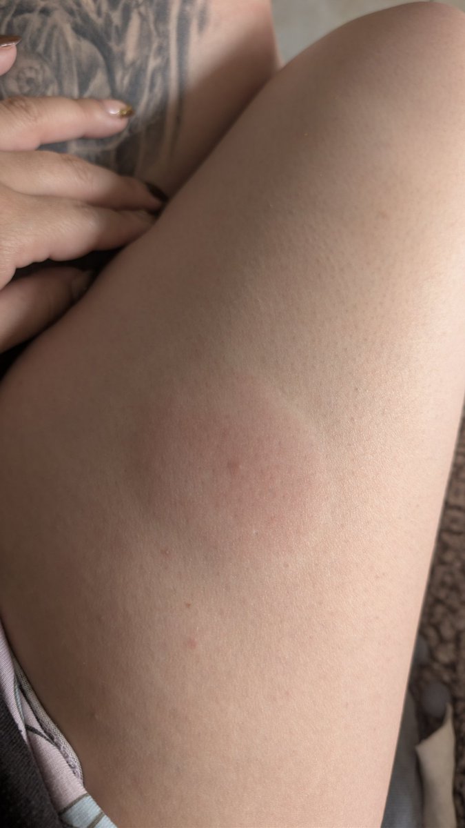 •🥀La Ulls🥀• tweet media