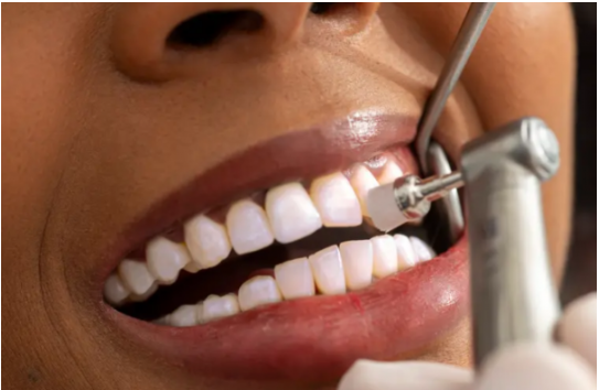 ابتكار جديد لوقاية الأسنان من التسوس .. كيف يعمل؟ 