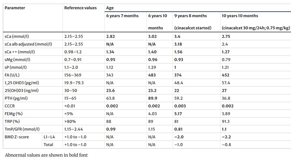Ped_Neph's tweet image. Familial hypocalciuric hypercalcemia (FHH) is a rare genetic disorder of calcium regulation. FHH type 3 (FHH3) is caused by pathogenic variants in AP2S1. Read these Clinical Insights on cinacalcet therapy in a symptomatic 11-yr-old girl w/FHH3.
link.springer.com/article/10.100…