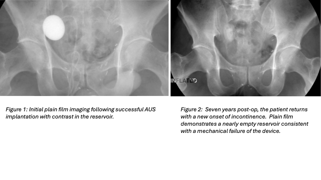 Mayo Clinic Urology tweet media