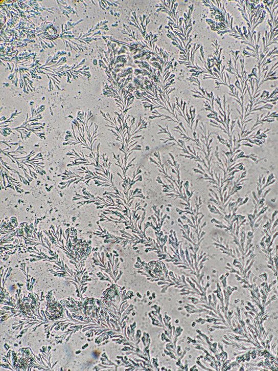 choquei's tweet image. 🚨VEJA: Secreção vaginal vistos pelo microscópio parecem flores.