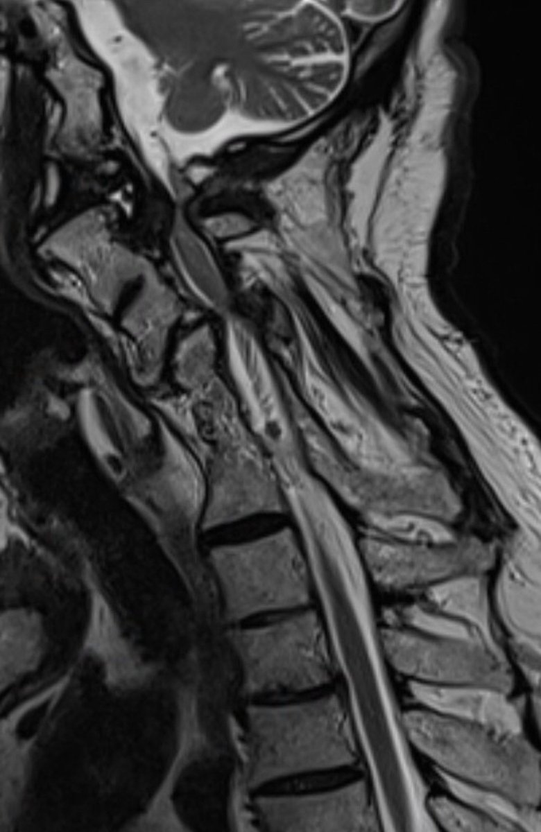 Andrew J. Grossbach, MD, FAANS tweet media