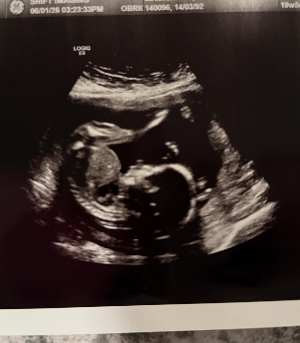 afixiaa's tweet photo. Halfway there sweet girl, can’t wait to hold you 💞 https://t.co/gox2gEoe5Q