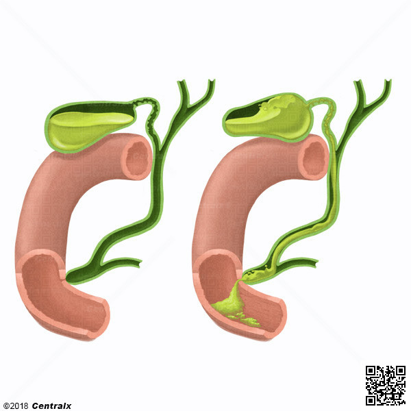 BulasMed's tweet image. Nova ilustração no Atlas do Corpo Humano: #Bile! 📚 #Anatomia

Agente emulsificador produzido no fígado e secretado para dentro do duodeno, para auxiliar a digestão das gorduras.

atlasdocorpohumano.com/p/imagem/liqui…
