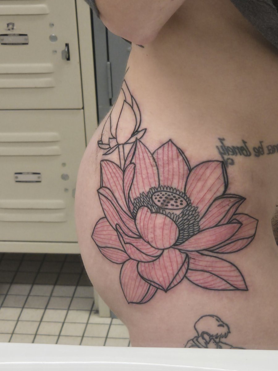 tomorrowhorror's tweet image. the bruising is crazy,,,,,