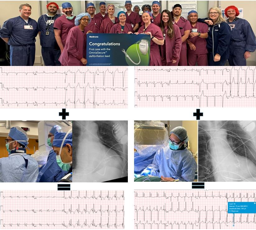 Brett Atwater tweet media