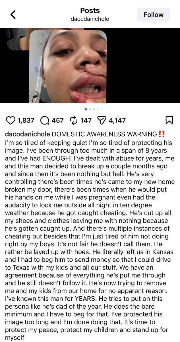 MLFootball's tweet image. 🚨🚨BREAKING NEWS: WARNING🚨🚨

#Chiefs star wide receiver Rashee Rice’s ex-girlfriend Dacoda Nichole has accused him in an Instagram post of 8 years of domestic abuse, alleging ongoing violence, including while she was pregnant.

She says she is no longer protecting his image…