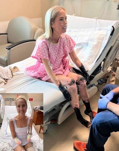 IanCopeland5's tweet image. Sherri Moody got bacterial meningitis. 

She turned septic and had to have her arms and legs amputated.

Today, we have vaccines that can prevent some of these cases. 

But people won't vaccinate their kids so we'll see alot more of this...