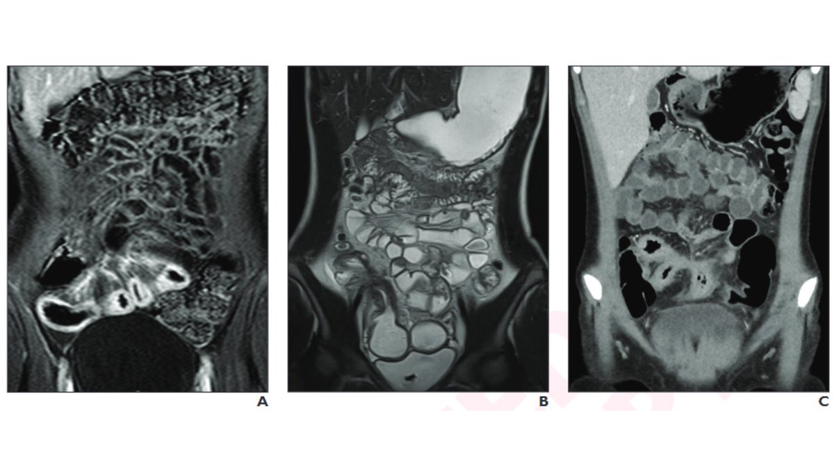Andrew Rosenkrantz tweet media