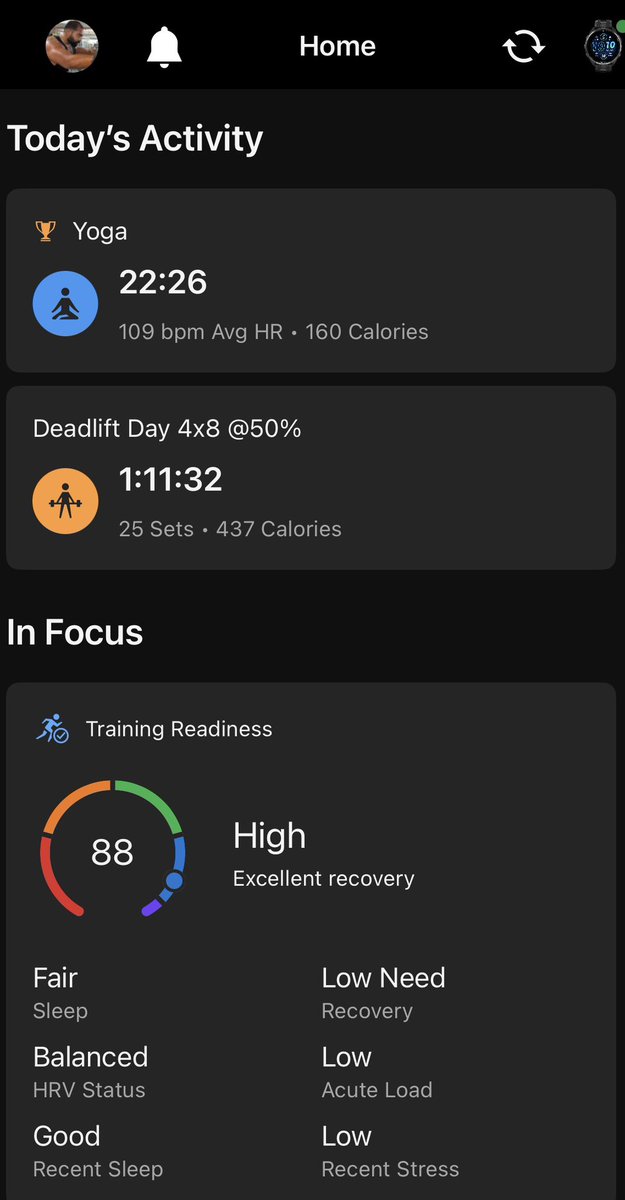 Rhythm_Reverie_'s tweet photo. #Thursday #Shoulder 

#FitnessJourney 🥳🥳🥳 https://t.co/gsWdUZRxha