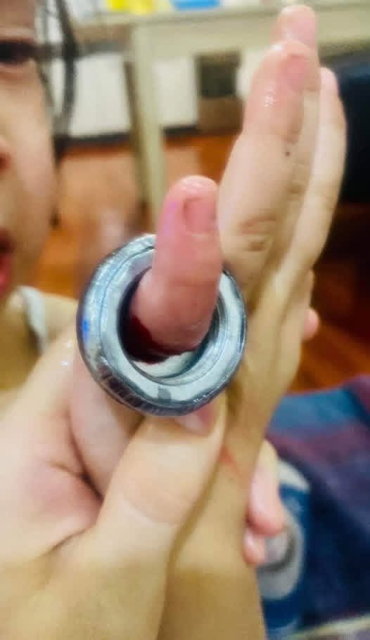 ✍️Өчигдөр орой дүү маань саваагүйтэж орны төмөр хуруундаа хийж гацаагаад ээж нь аав бид 2-т нь утсаар зураг явуулсан тул санд мэнд байгаа байгаа газраасаа гэр лүүгээ яаран очлоо.
Түргэн рүү залгахад Гэмтэл дээр очоорой гэсэн тул Гэмтэл рүү гацсан төмөртэй хурууг нь хөндчихгүйг