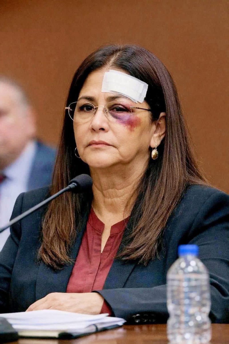 America lectures us on human rights, even for terrorists...
And then this is how they treat the wife of Venezuela’s President.

Beating up a harmless woman. This is their idea of “human rights.”