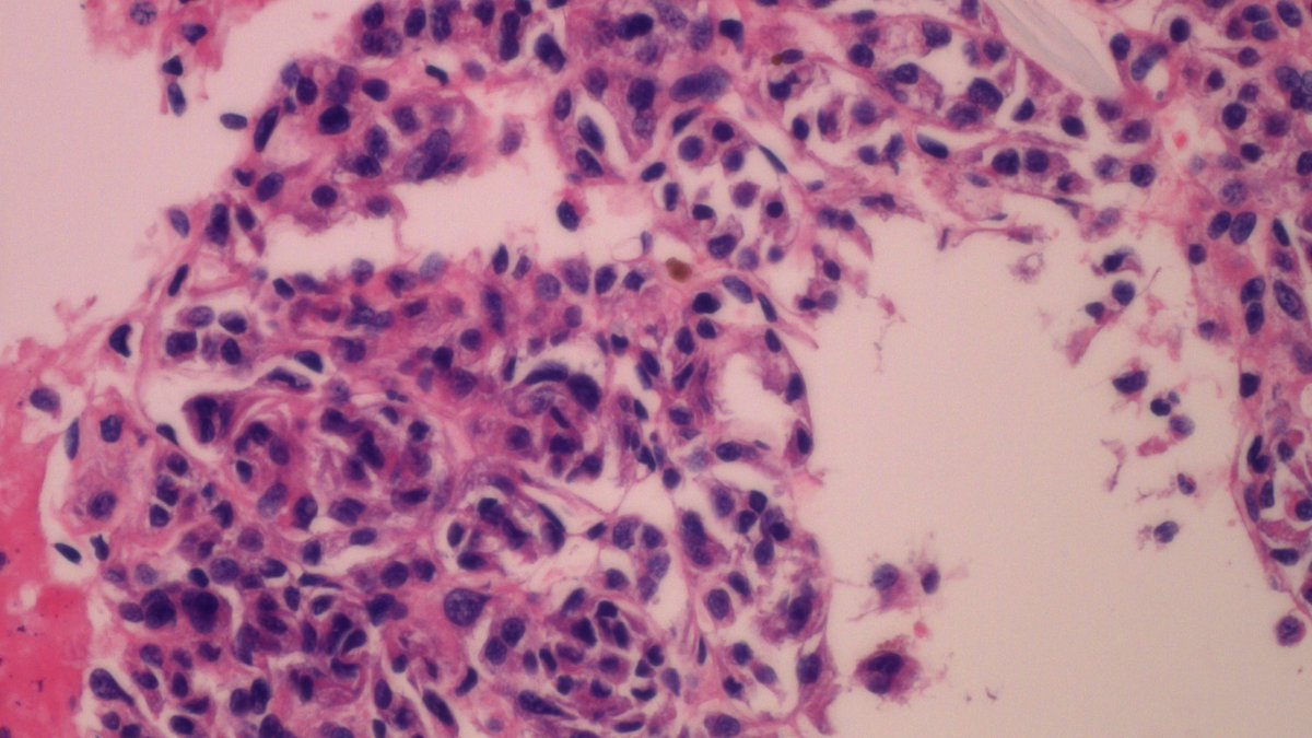 Dan Graham tweet media