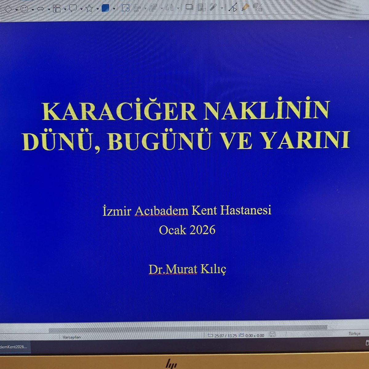 profdr_mkilic's tweet photo. Bir organ.
Bir beden.
Bir hayat.

Karaciğer nakli, cerrahi teknikten çok daha fazlası.
Bilimin sabırla ilerleyen hikâyesi.

Bilgi paylaşıldıkça güçlenir.
Bilim, anlatıldıkça çoğalır.

#KaraciğerNakli
#OrganNakli
#Transplantasyon
#TransplantCerrahisi
#CerrahiBilim
#TıpBilimi https://t.co/hYpPCKQHJp