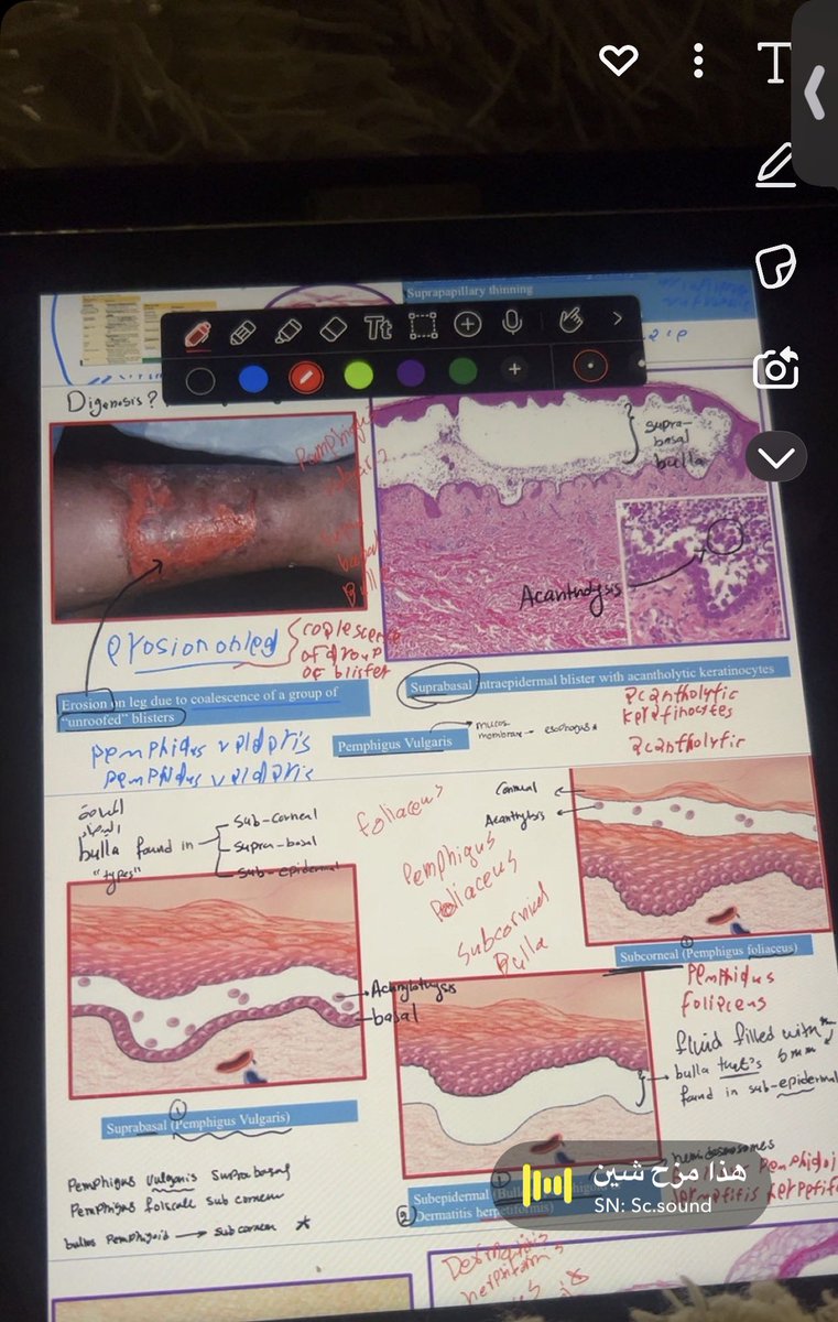 Musculoskeletal block🦴✅
البعبع
