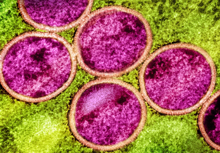 We should not underestimate what mpox can do.

New strains. New risks. Same mistake?

🔗nature.com/articles/d4158…

#Mpox #GlobalHealthSecurity