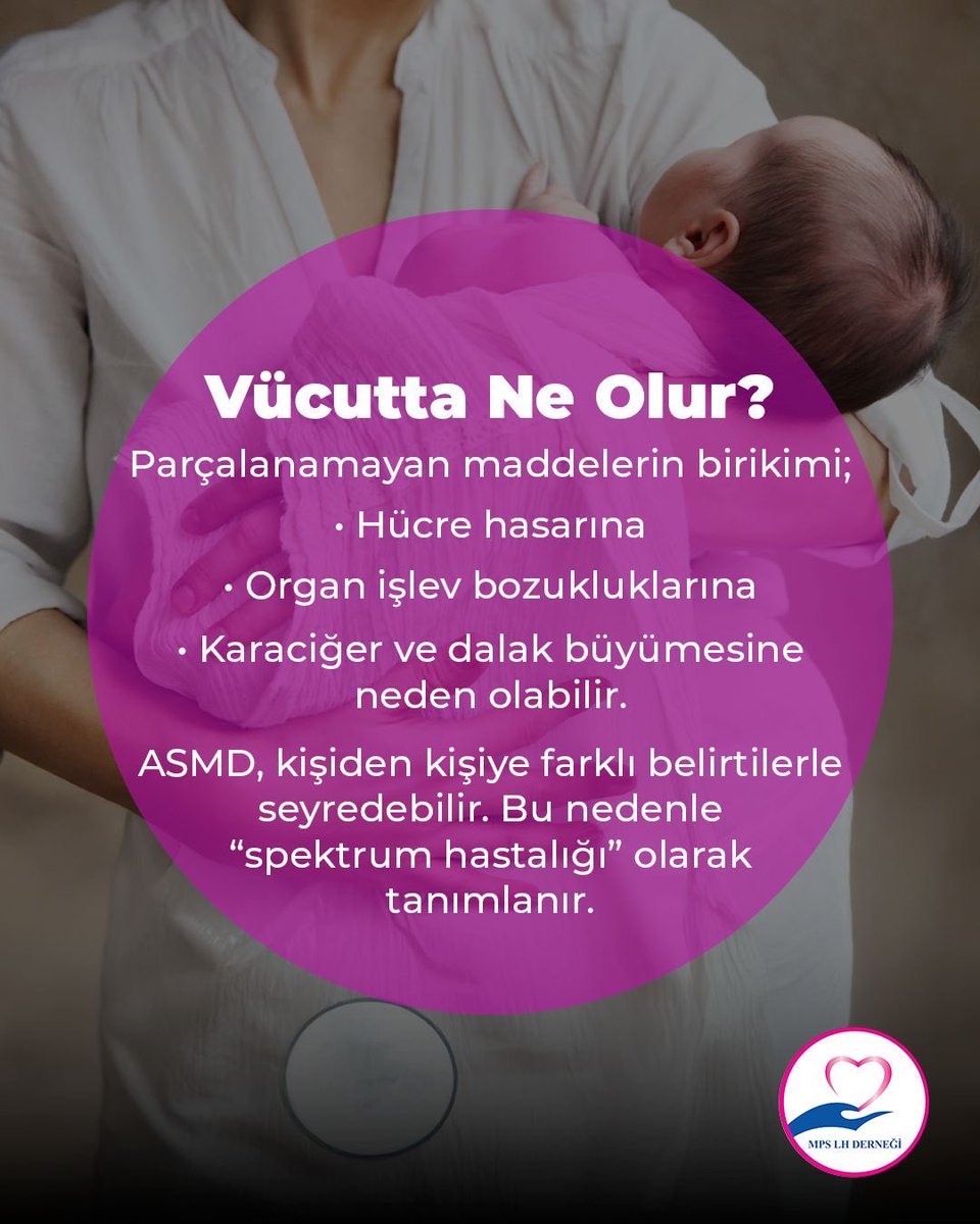 Niemann-Pick Hastalığı Tip A ve Tip B, diğer adıyla
Asit Sfingomyelinaz Eksikliği (ASMD), nadir görülen,
genetik ve ilerleyici bir lizozomal depo hastalığıdır.
.
.
.
#mpslhderneği #mps #sağlık