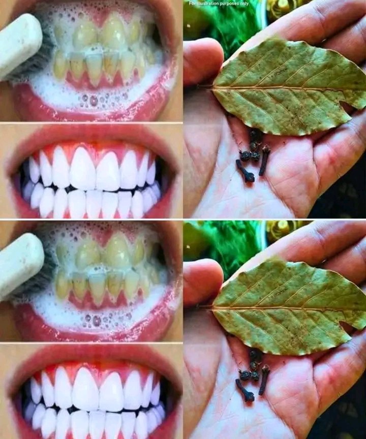 🦷🌿 Cleaner smile, natural version 🌿🦷

1️⃣ ️⃣ The basic move
A good brushing is still essential.
Without it, even the best tricks don't work miracles.

2️⃣ 🍃 The natural combo… See more