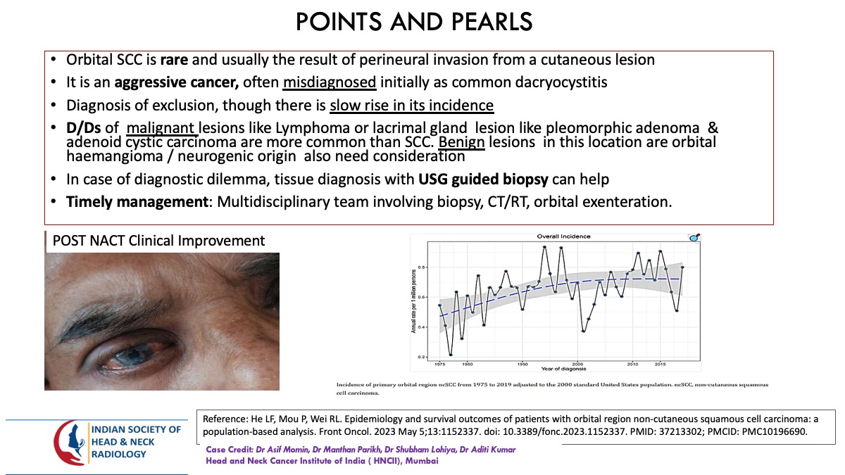 teamishnr's tweet photo. #caseoftheweekanswer

Please find the answer
#radiology #caseoftheweek #headandneck #radiologycases #dailywork #ISHNR #teaching #research #imaging #FOAM #FOAMRad #FOAMMed

Visit our website: https://t.co/QrOexqNykg
All Cases: https://t.co/0xaPvoBy5H https://t.co/bXlLVYasaG