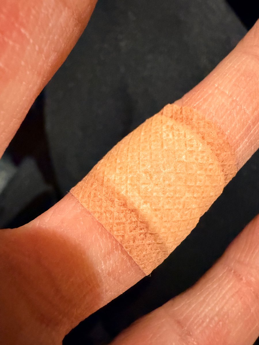 やっぱりトゲだったみたい、無事に取れました (^^)