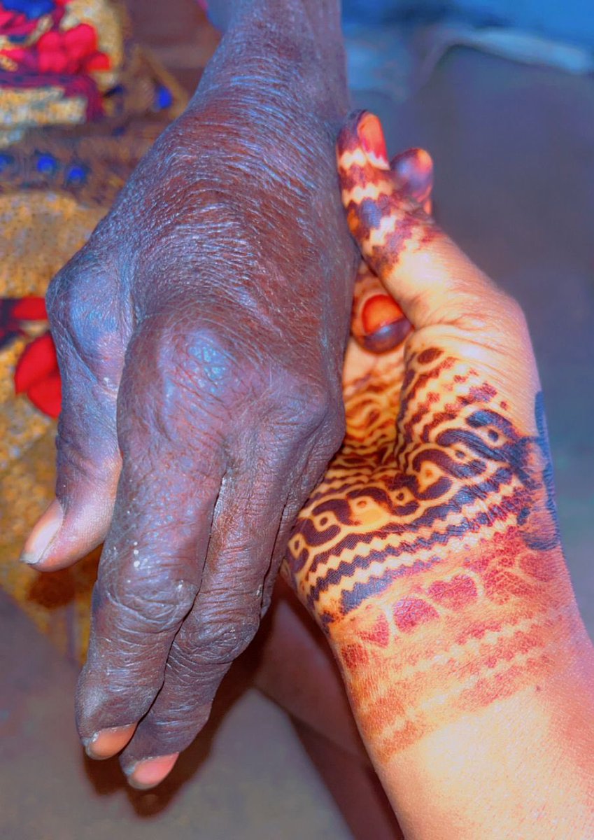 Today I visited my grandmother in another town,we spent a lot of time talking, laughing and reminiscing, then the room suddenly fell quiet,she looked at me deeply and said:

“Zainab, when I was your age, I had already given birth to your father,But look at you now, still choosing