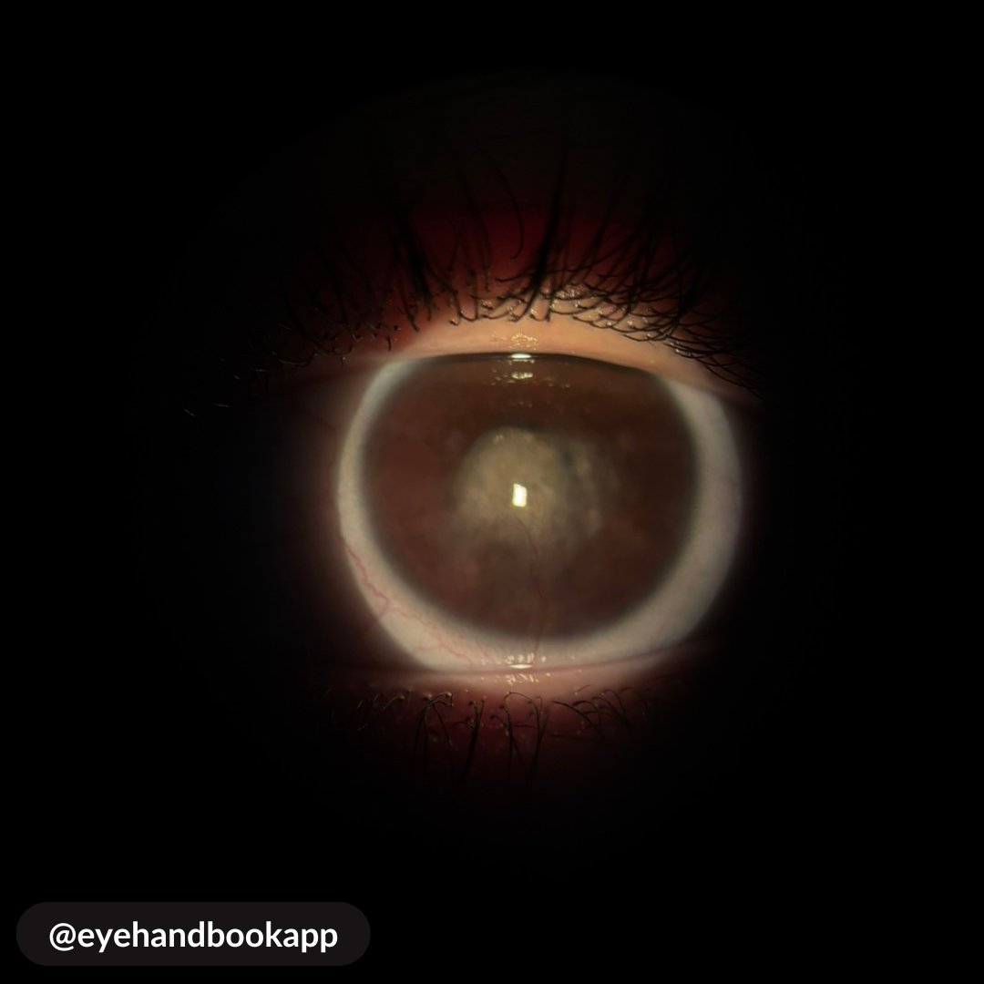 Eye Handbook tweet media