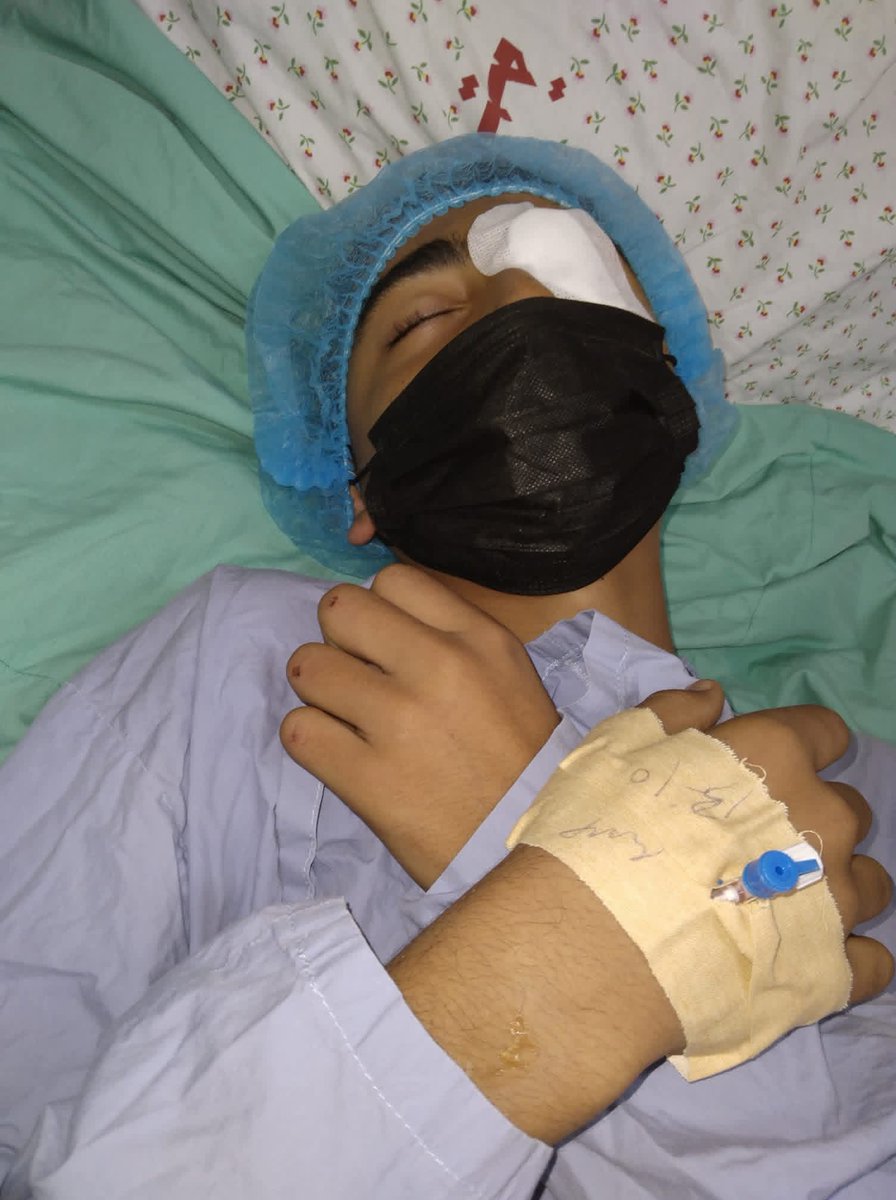 AmynY87692's tweet photo. I was injured in my left eye and had two surgeries due to the war. Because of my injury, I couldn't complete my university studies. I have two years left. Please help me get treatment so I can stand again and finish my studies
https://t.co/p40a0j4B2r https://t.co/xScHayVvAd