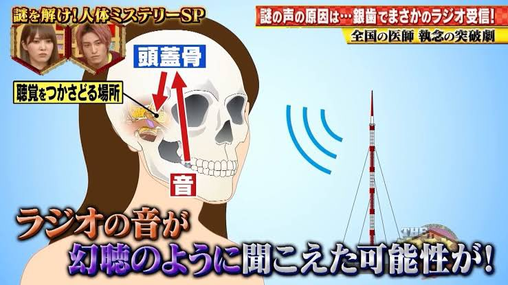 Dirg_rocketdyne's tweet image. 鉱石ラジオの原理で幻聴を拾う場合がある。銀歯ラジオと呼ばれるものだ。銀歯含有の組成が偶然ある状態になっていた場合、鉱石ラジオになり放送電波を拾ってしまう事態が稀に起こるらしい。…