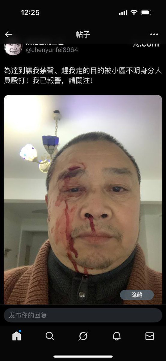 ShengXue_ca's tweet image. 是黑社会加入了维稳队伍？
还是维稳工作黑社会化了？

2026年1月8日上午 9 点左右，秋雨圣约教会会友 陈云飞 在自己居住的小区内，被 一名男性不明身份人员当面殴打。

陈云飞没有还手。
施暴过程中，对方明确警告他“不要在 X（原 Twitter）上发帖”，目的非常清楚，就是恐吓、噤声。…