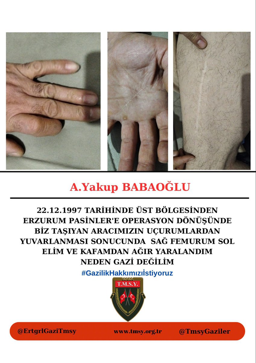<a href="/celebimehmeta/">Mehmet Ali Çelebi</a> Gazilik mücadelemizde yanımızda durarak bizlere moral veren Sn.<a href="/celebimehmeta/">Mehmet Ali Çelebi</a> vekilimize teşekkür ederiz. Desteğiniz kıymetlidir.

#GazilikHakkımızıİstiyoruz
<a href="/RTErdogan/">Recep Tayyip Erdoğan</a>
<a href="/MahinurOzdemir/">Mahinur Özdemir Göktaş</a>
<a href="/drbetulsayan/">Dr.Betül Sayan Kaya 🇹🇷</a>
<a href="/hulusiakarmedya/">Hulusi AKAR</a>
<a href="/kocakkonuralp/">Konur Alp Koçak</a>
<a href="/dtcuneytaldemir/">Dt. Cüneyt Aldemir 🇹🇷</a>
<a href="/ztarikdaroglu/">Zafer TARIKDAROĞLU</a>