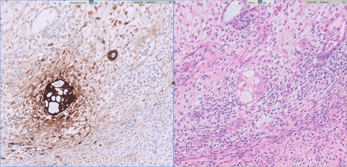 Ankur Sangoi tweet media