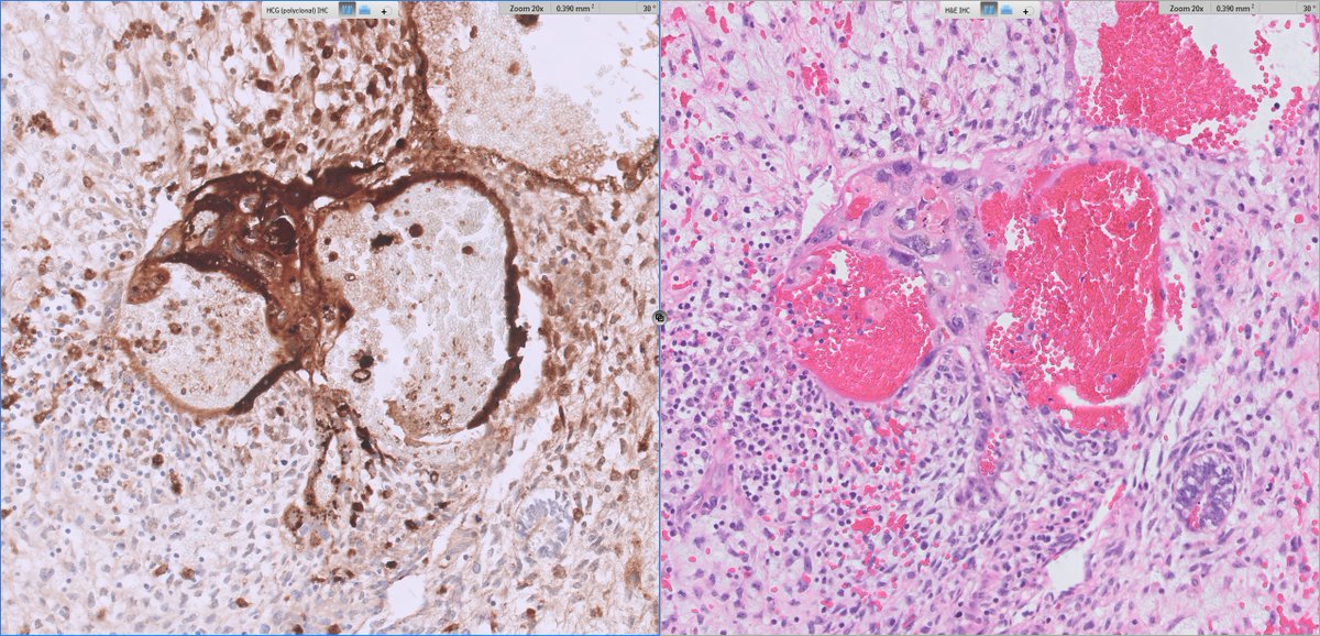 Ankur Sangoi tweet media