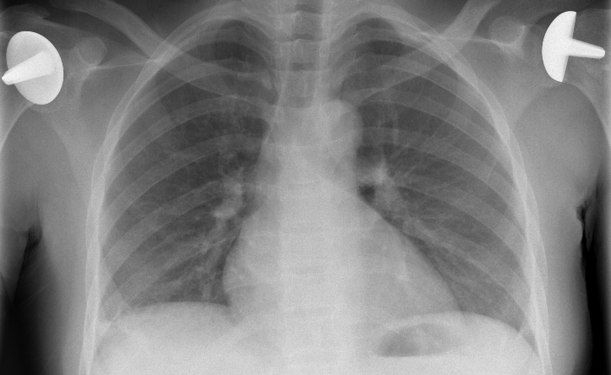 Jack Garnham tweet media