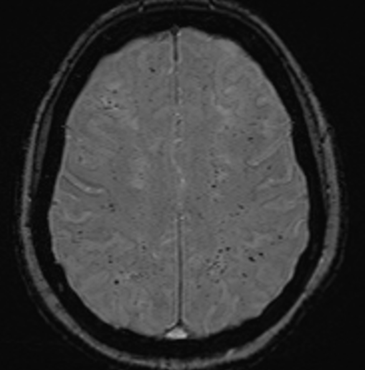 Jack Garnham tweet media