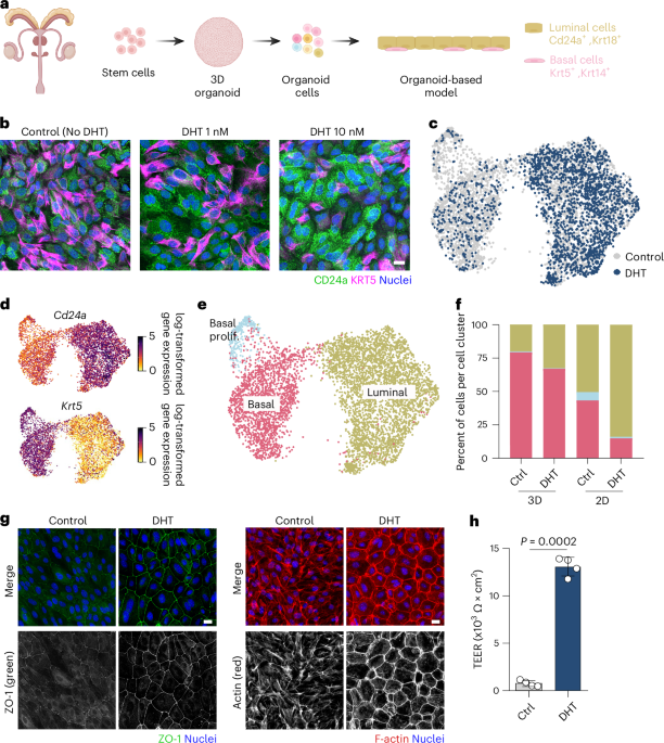 NatureMicrobiol's tweet image. Out Now! Uropathogenic Escherichia coli invade luminal prostate cells via FimH–PPAP receptor binding dlvr.it/TQDn9T #EscherichiaColi #Microbiology #Infection