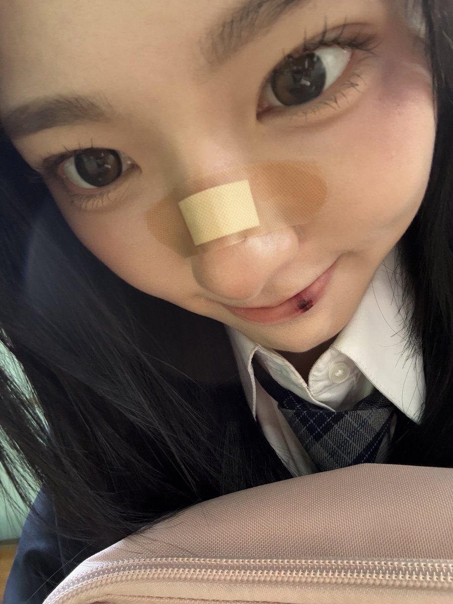 ✩ › TWITTER ⊹ 08.01.2026 ‧₊˚. ➭ #XINYU : J'ai mal ㅠ (#tripleS