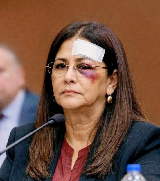 martytaka777's tweet image. 『ベネズエラ大統領の妻シリア・フローレスは、このような形で法廷に引き出された。』とされるこの画像は、フェイクだと判明。米国批判したい方々、残念でした。
ソース
misbar.com/en/factcheck/2…