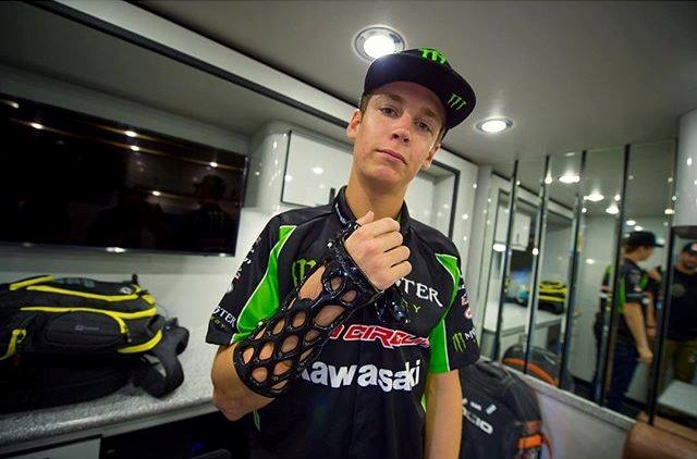 ActivArmor's tweet image. Did you know? Patient satisfaction and hygiene are top priorities for today’s #orthopaedic clinics and physicians. #ClinicManagement #HealthcareTechnology #3DPrintedCast #MedicalInnovation #PatientExperience #ActivArmor #SportsMedicine