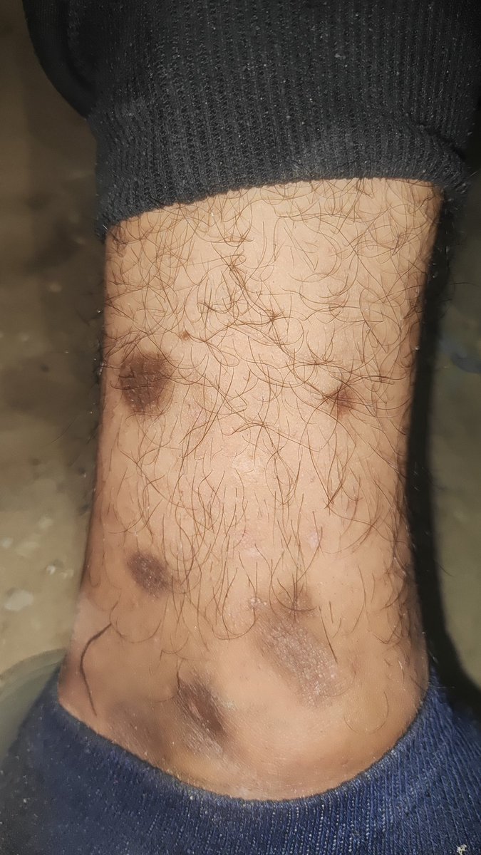 I'm really tired, so tired 
I don't want any views, all I want is for her to stay close to my family. 
If you’re scrolling, PLEASE leave a dot . it's just a dot 
gofundme.com/f/donate-help-…